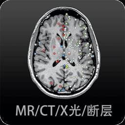 影像解剖图谱软件
