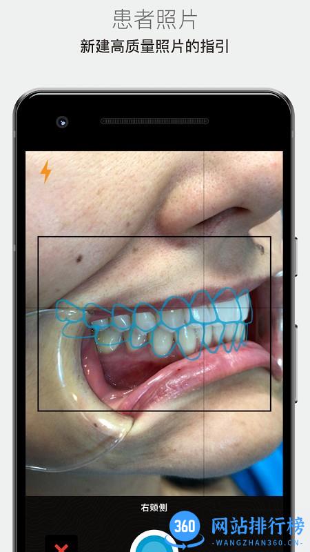 invisalign矫治器(IPU) v5.8.0 安卓版 2